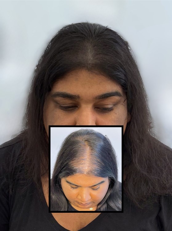 treatment candidates