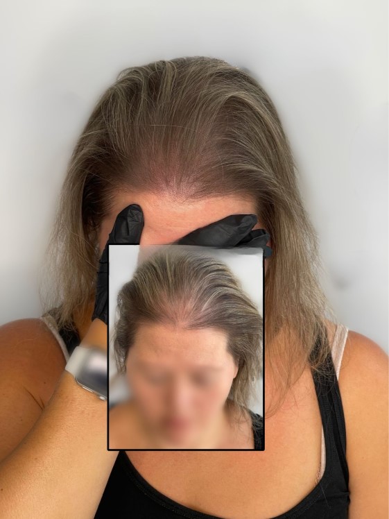 treatment candidates